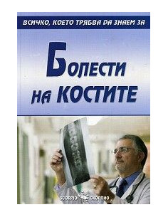 Болести по костите