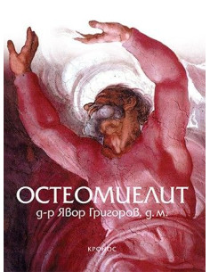 Остеомиелит