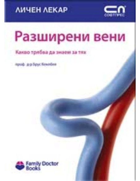 Разширени вени