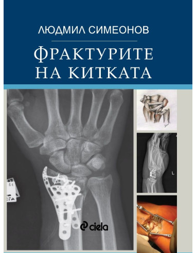 Фрактурите на китката