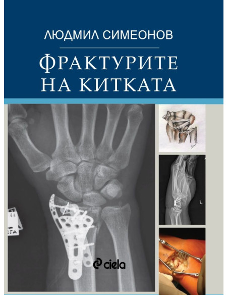 Фрактурите на китката